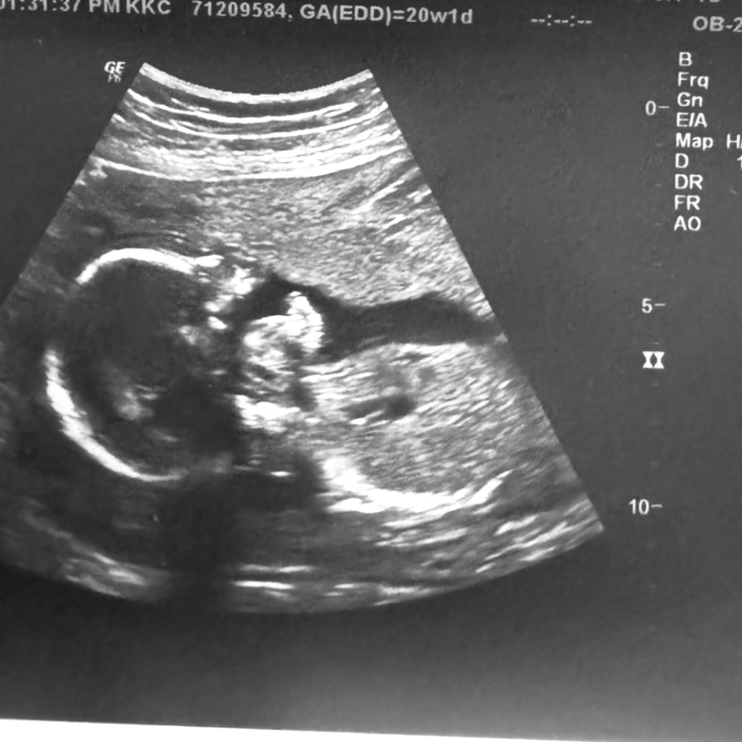 Photo shared by Kimberly for their Babylist baby registry.