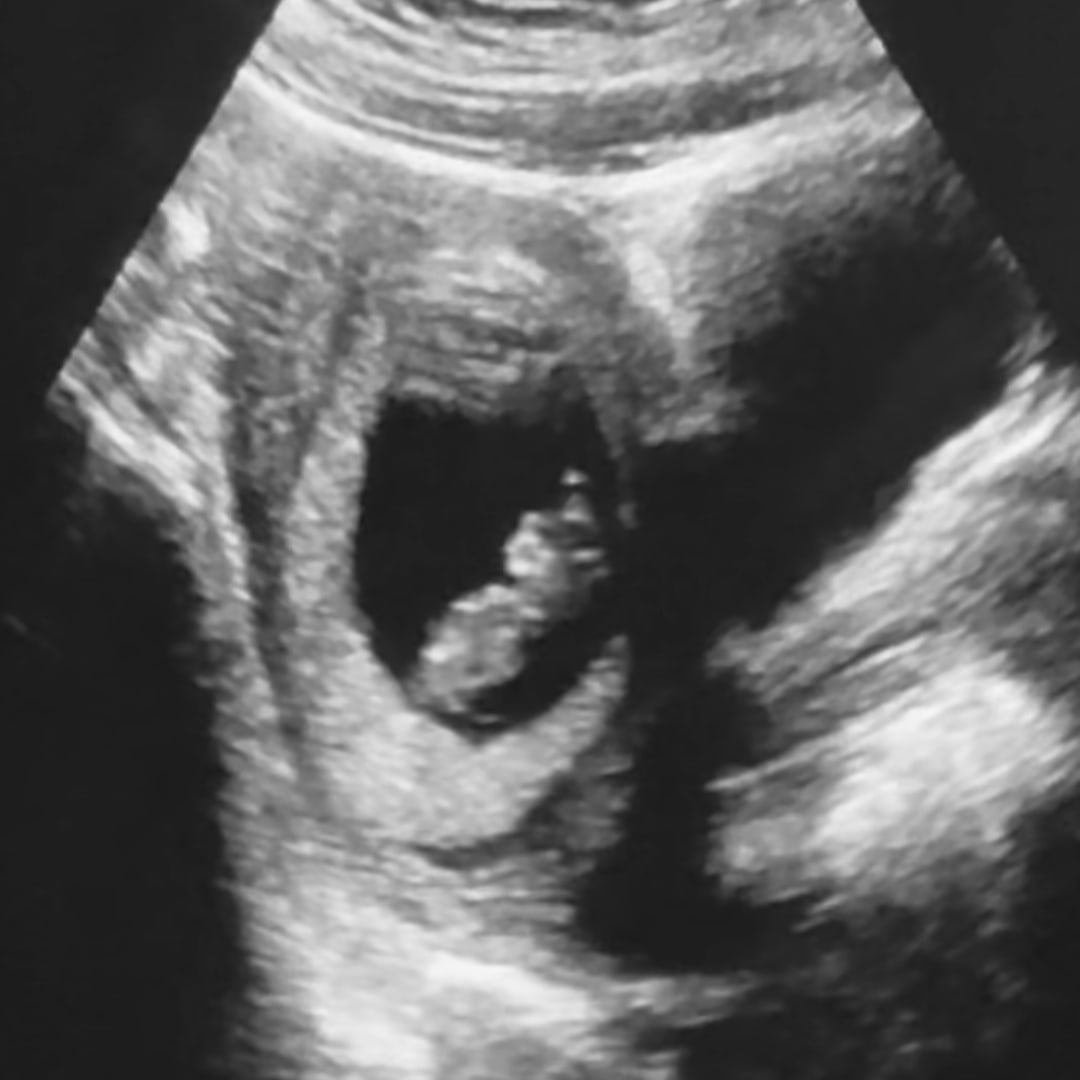 Photo shared by Cierra for their Babylist baby registry.