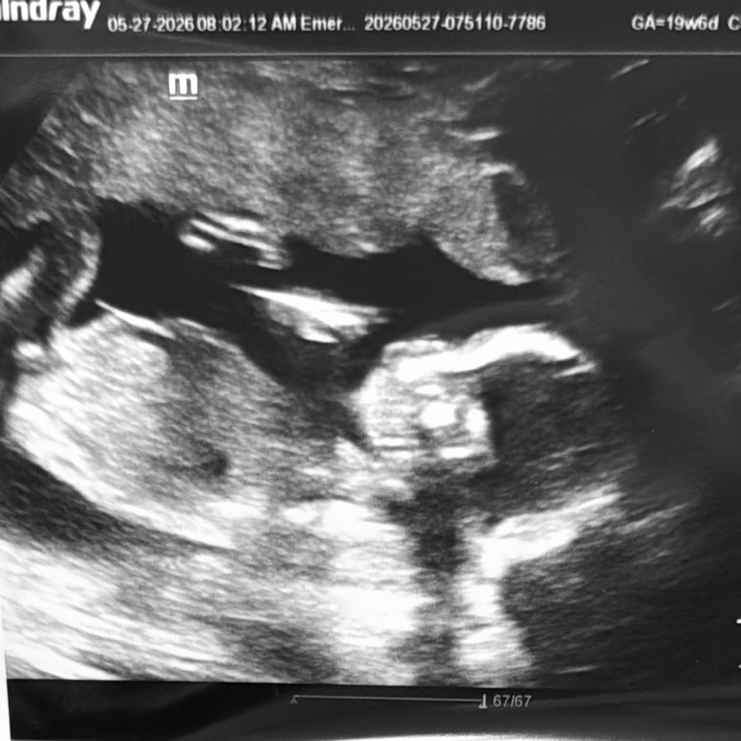 Photo shared by Makenzie for their Babylist baby registry.