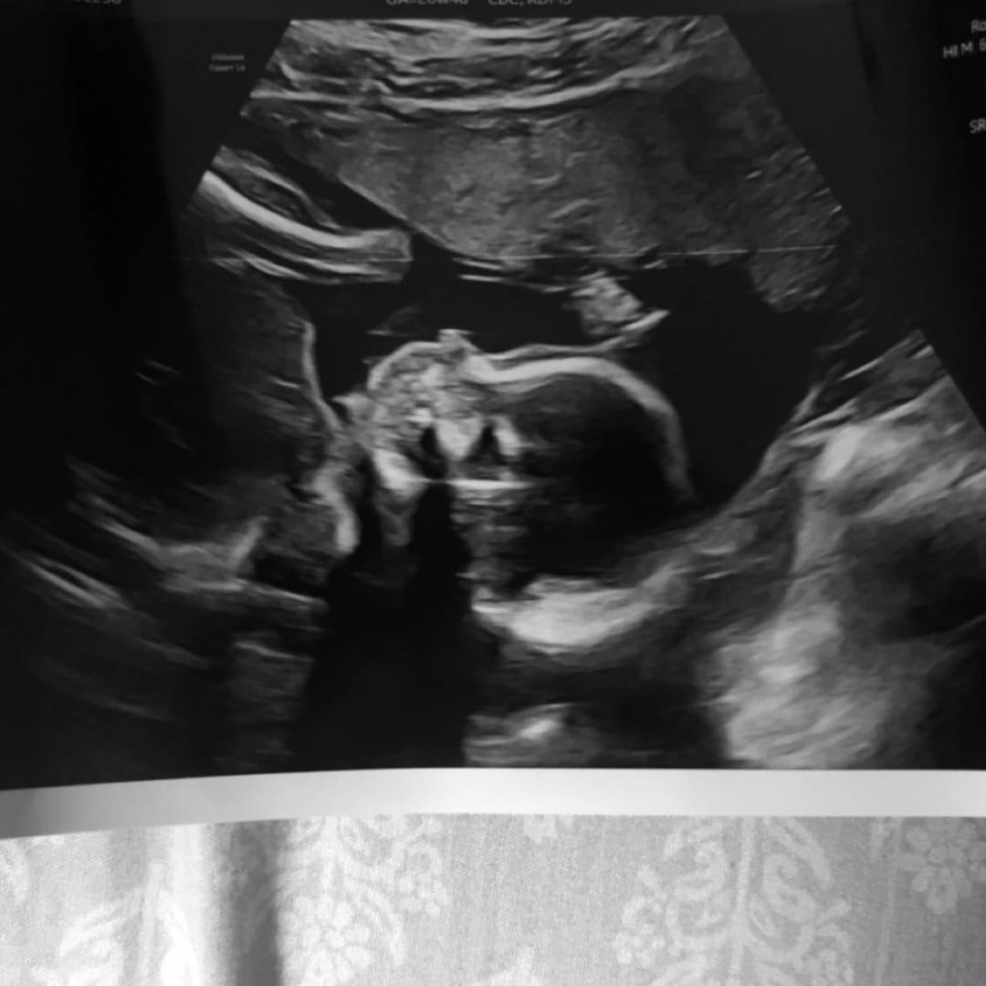 Photo shared by Kloey for their Babylist baby registry.