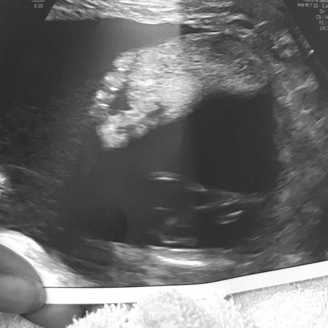 Photo shared by Sabrina for their Babylist baby registry.
