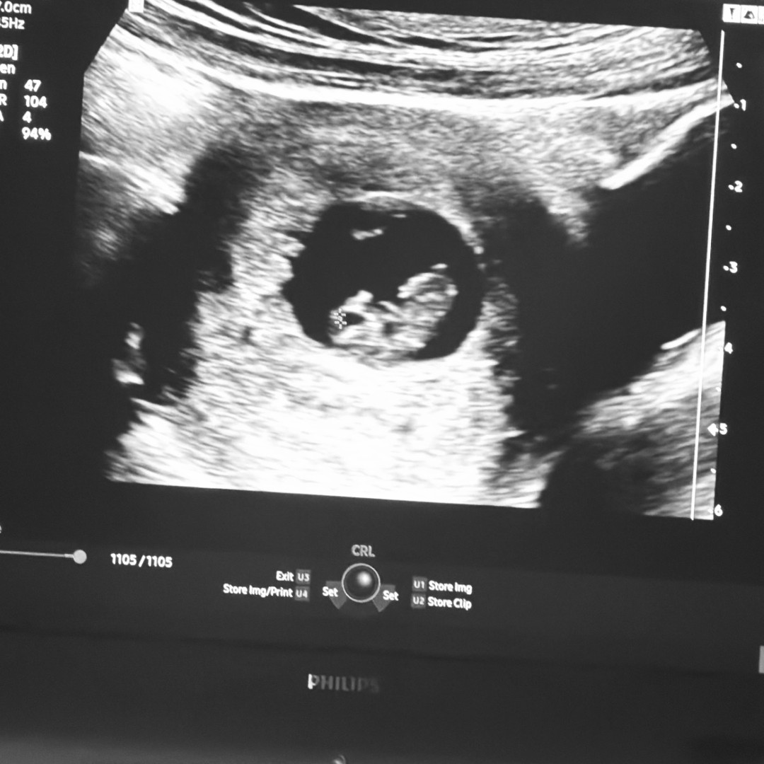 Photo shared by Yesenia for their Babylist baby registry.