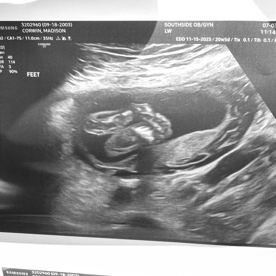 Photo shared by Madison for their Babylist baby registry.