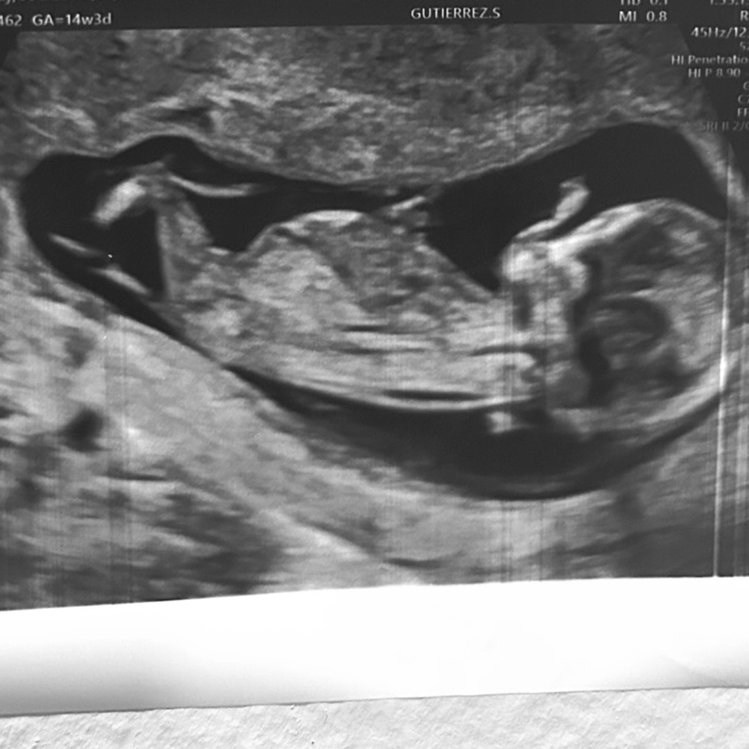 Photo shared by Joely for their Babylist baby registry.