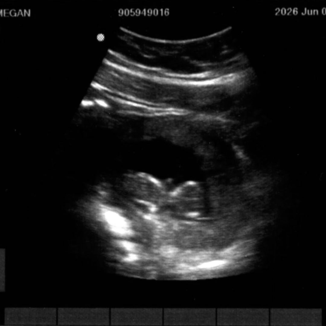 Photo shared by Megan for their Babylist baby registry.