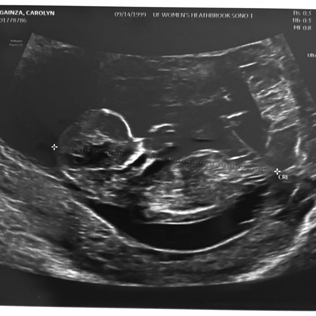 Photo shared by Carolyn for their Babylist baby registry.