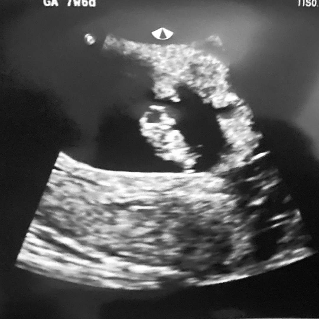 Photo shared by Jessie for their Babylist baby registry.