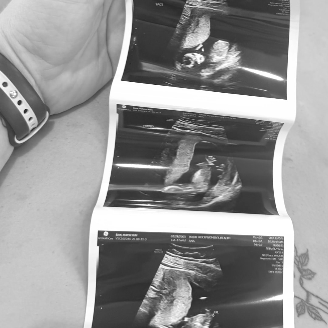 Photo shared by Hayleigh for their Babylist baby registry.