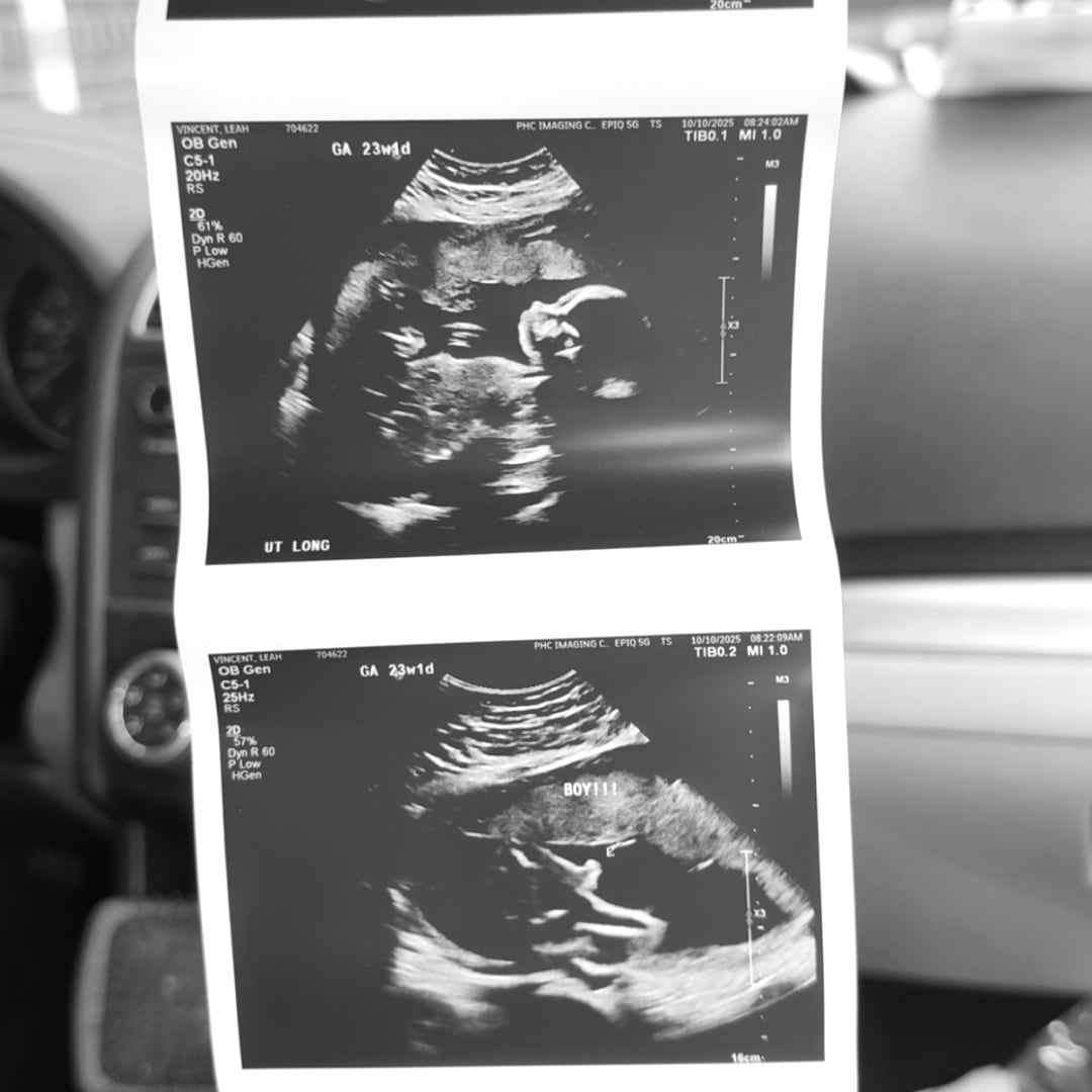 Photo shared by Leah for their Babylist baby registry.