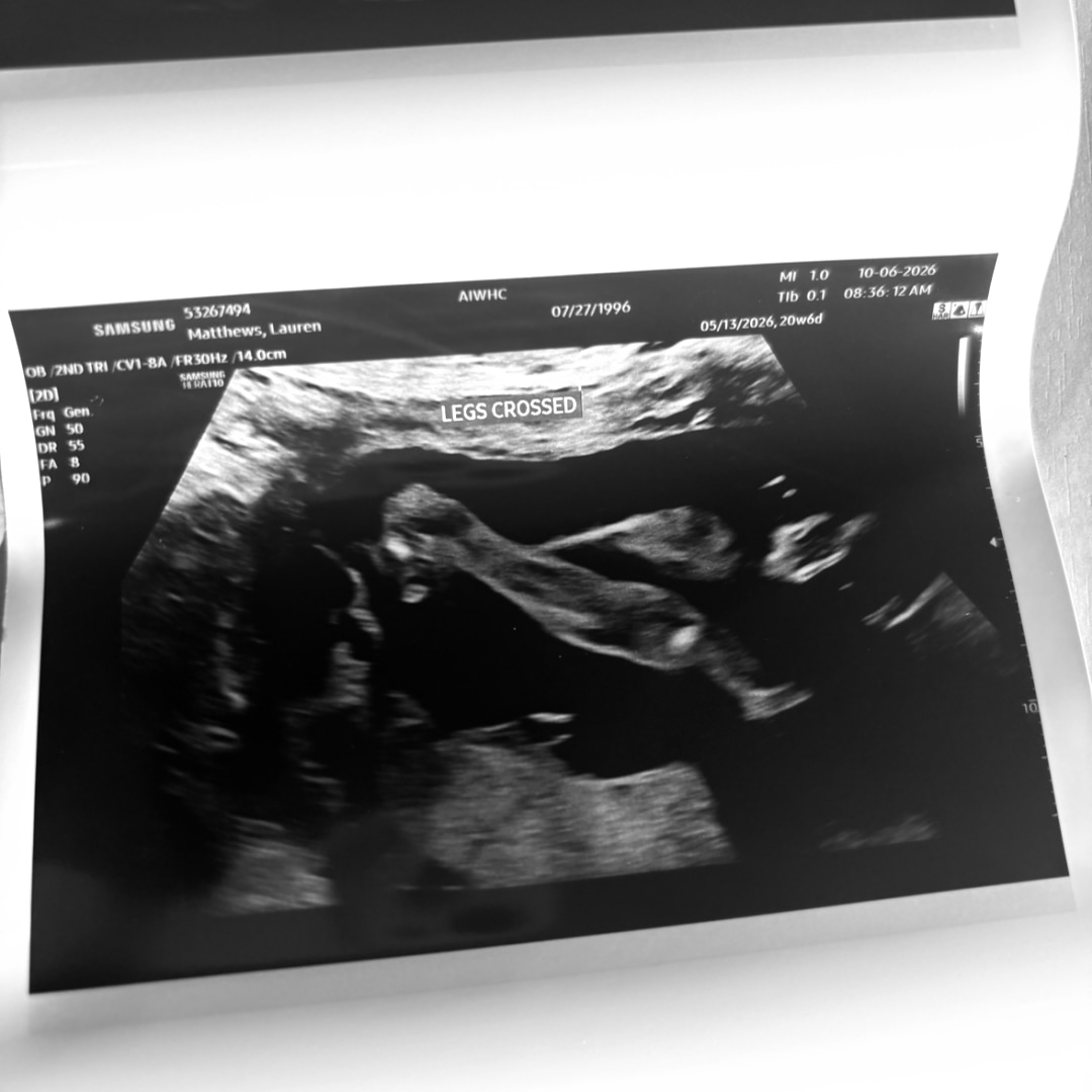Photo shared by Lauren for their Babylist baby registry.