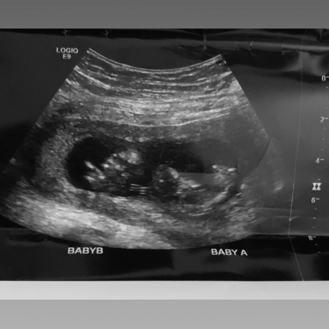 Photo shared by Tahlia for their Babylist baby registry.