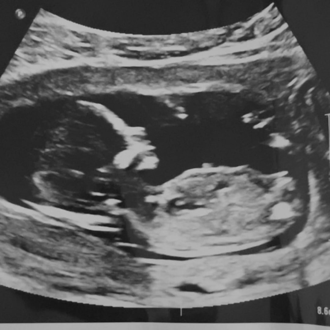 Photo shared by Juana for their Babylist baby registry.