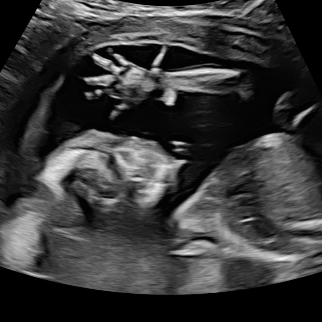 Photo shared by Hannah for their Babylist baby registry.