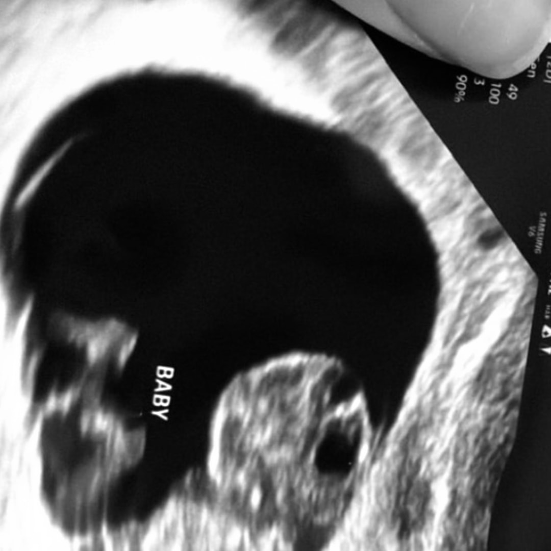 Photo shared by Cleo for their Babylist baby registry.