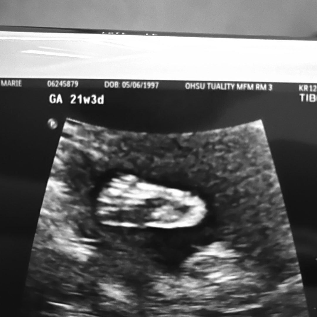 Photo shared by Hannah for their Babylist baby registry.