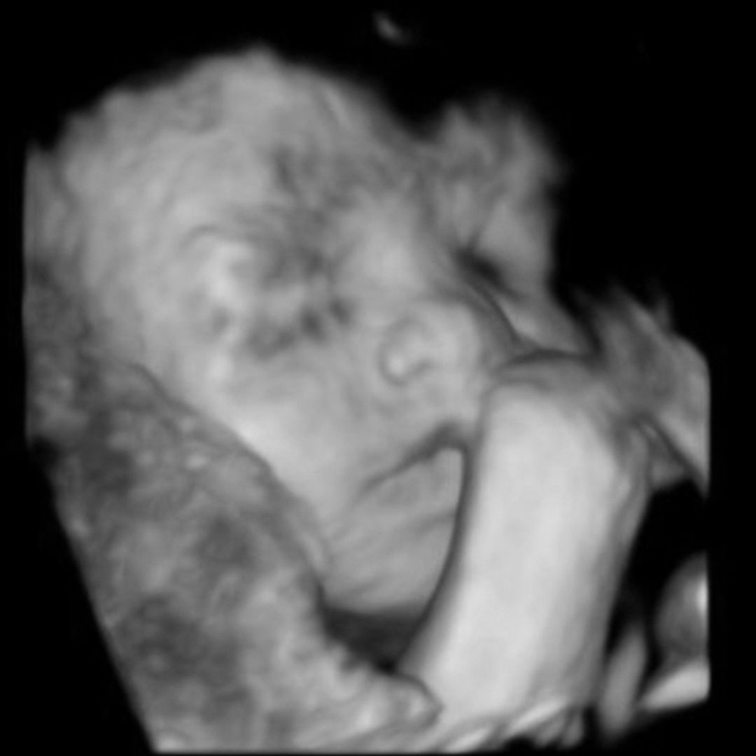Photo shared by Alexandra for their Babylist baby registry.