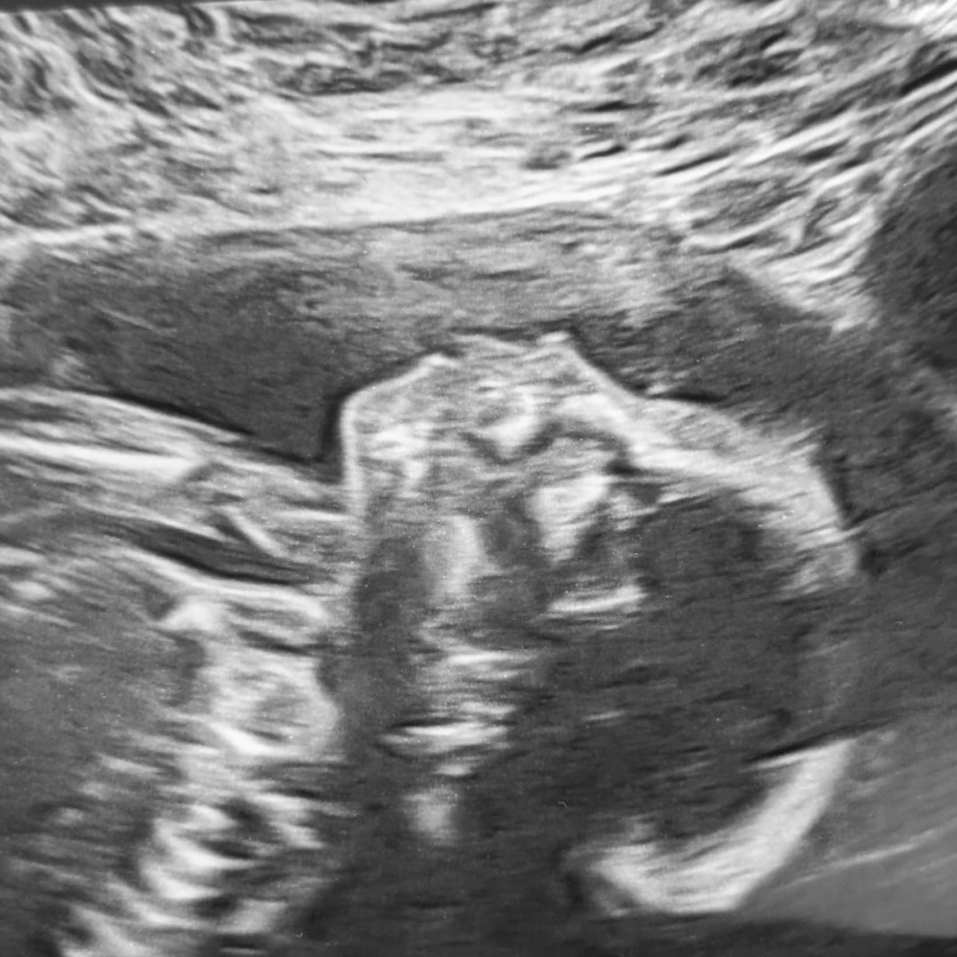 Photo shared by Taylor for their Babylist baby registry.