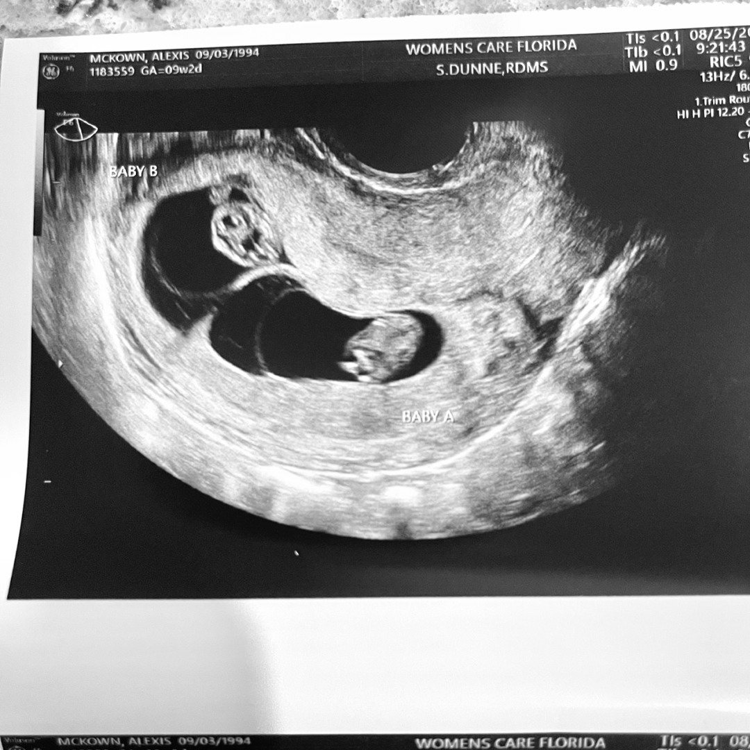 Photo shared by Alexis for their Babylist baby registry.