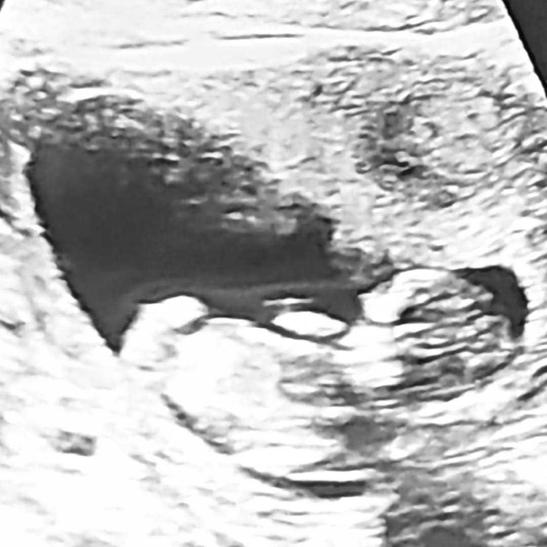 Photo shared by Sydney for their Babylist baby registry.