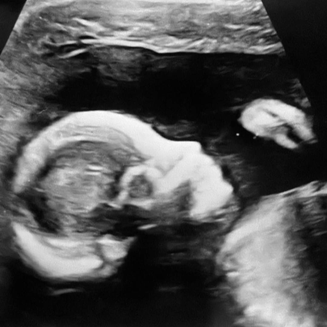 Photo shared by Esme for their Babylist baby registry.