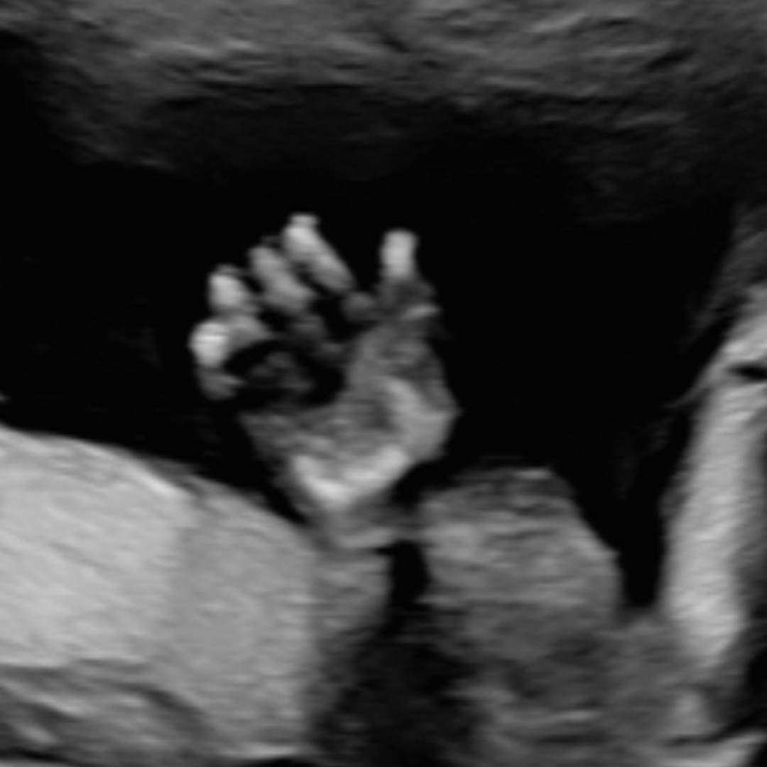Photo shared by Devin for their Babylist baby registry.