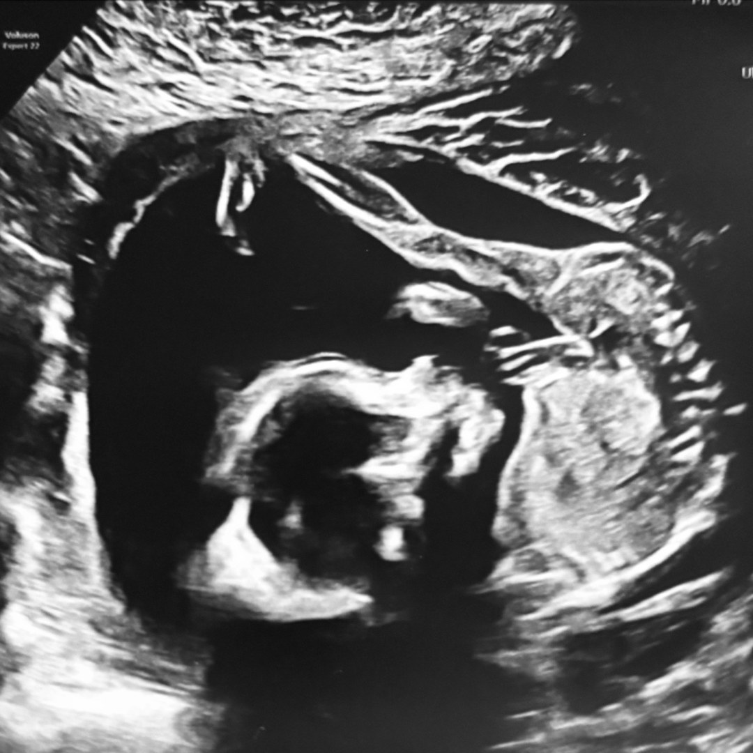 Photo shared by Lindsey for their Babylist baby registry.