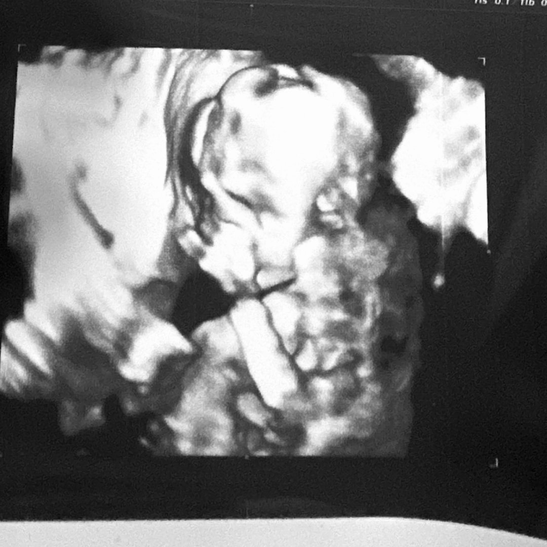 Photo shared by Anna for their Babylist baby registry.