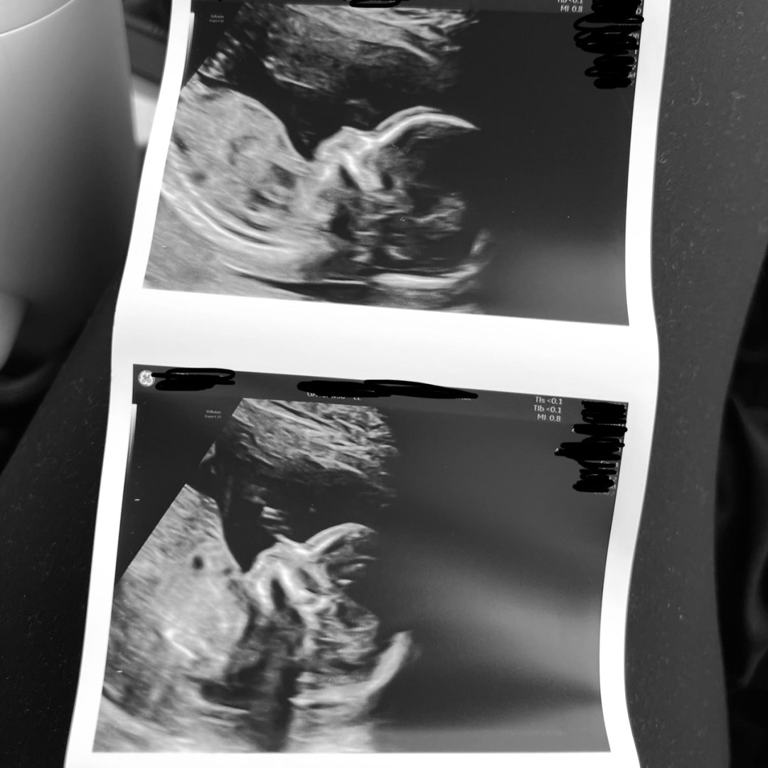 Photo shared by Nadine for their Babylist baby registry.