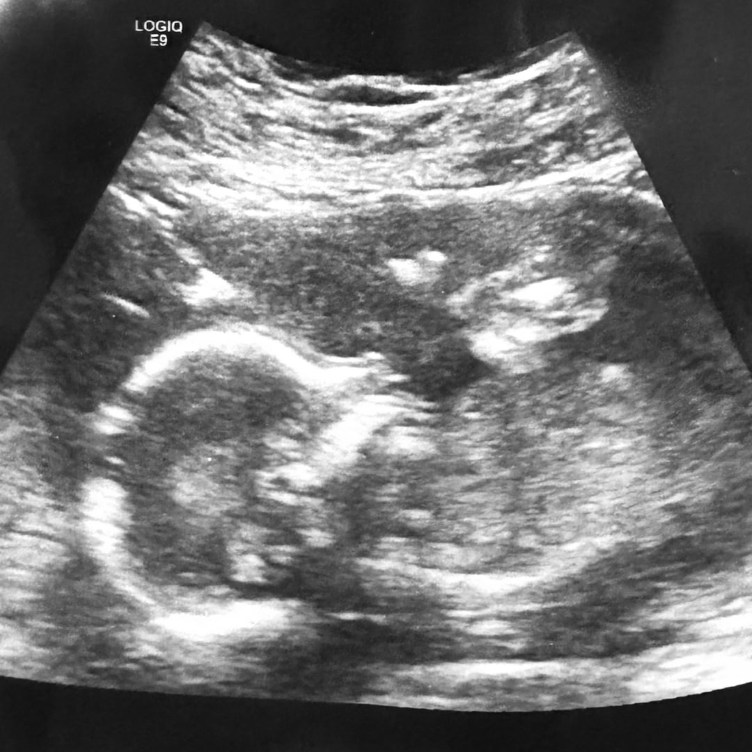 Photo shared by Alex for their Babylist baby registry.