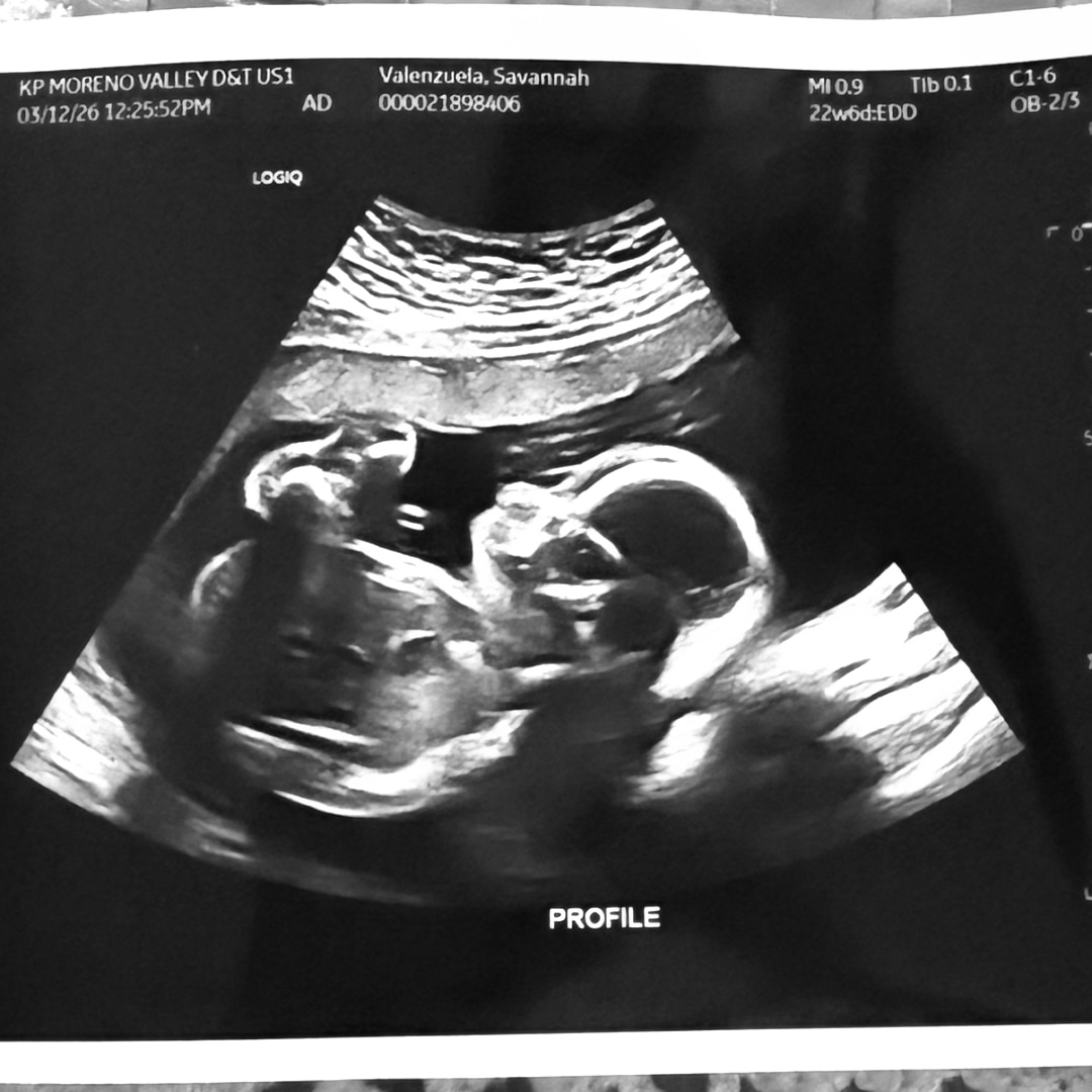 Photo shared by Savannah for their Babylist baby registry.