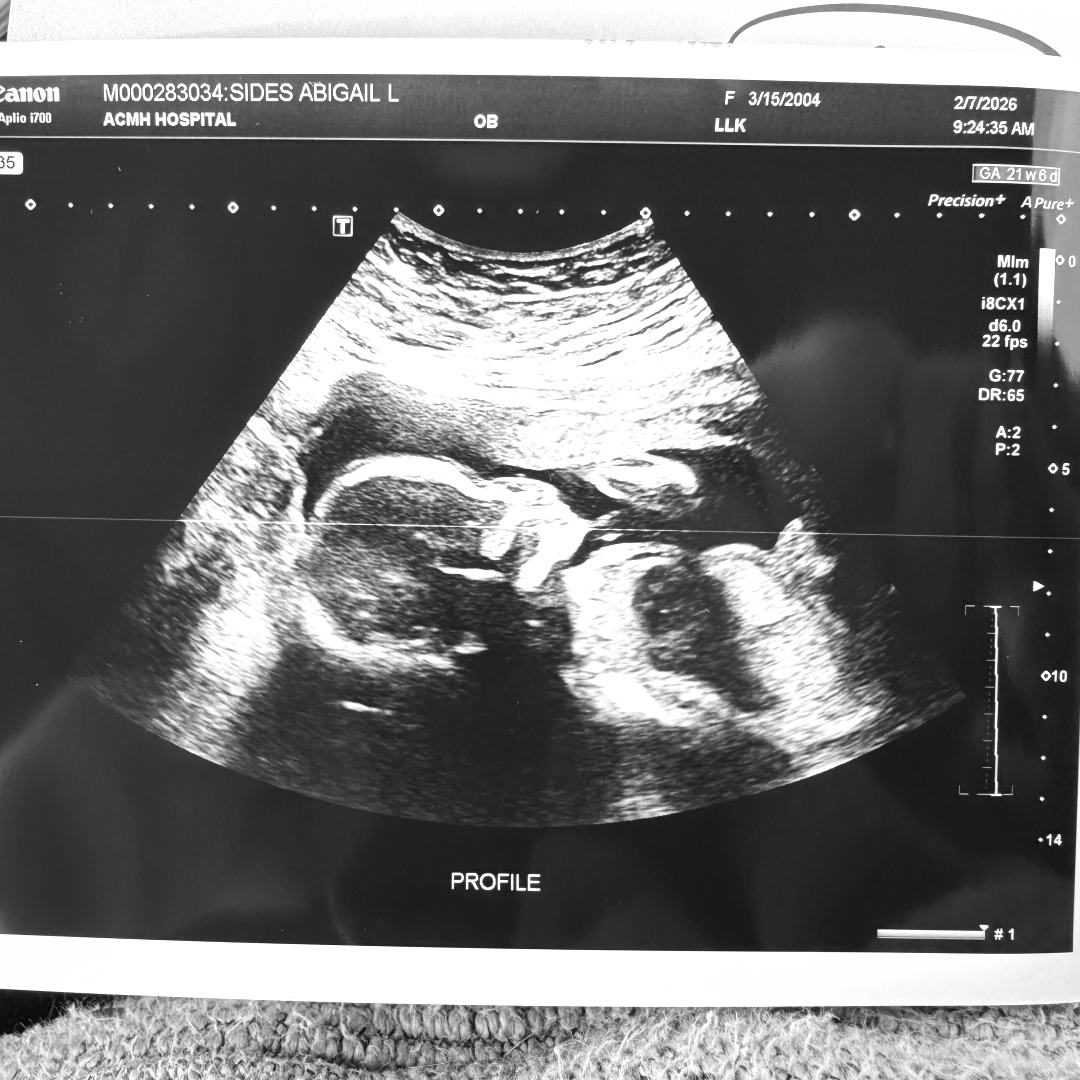 Photo shared by Abby for their Babylist baby registry.