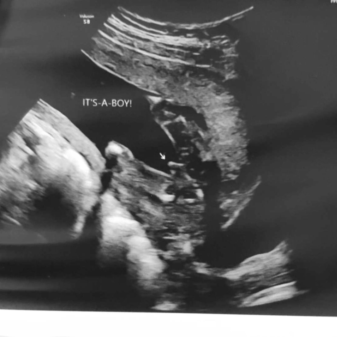 Photo shared by Lily for their Babylist baby registry.