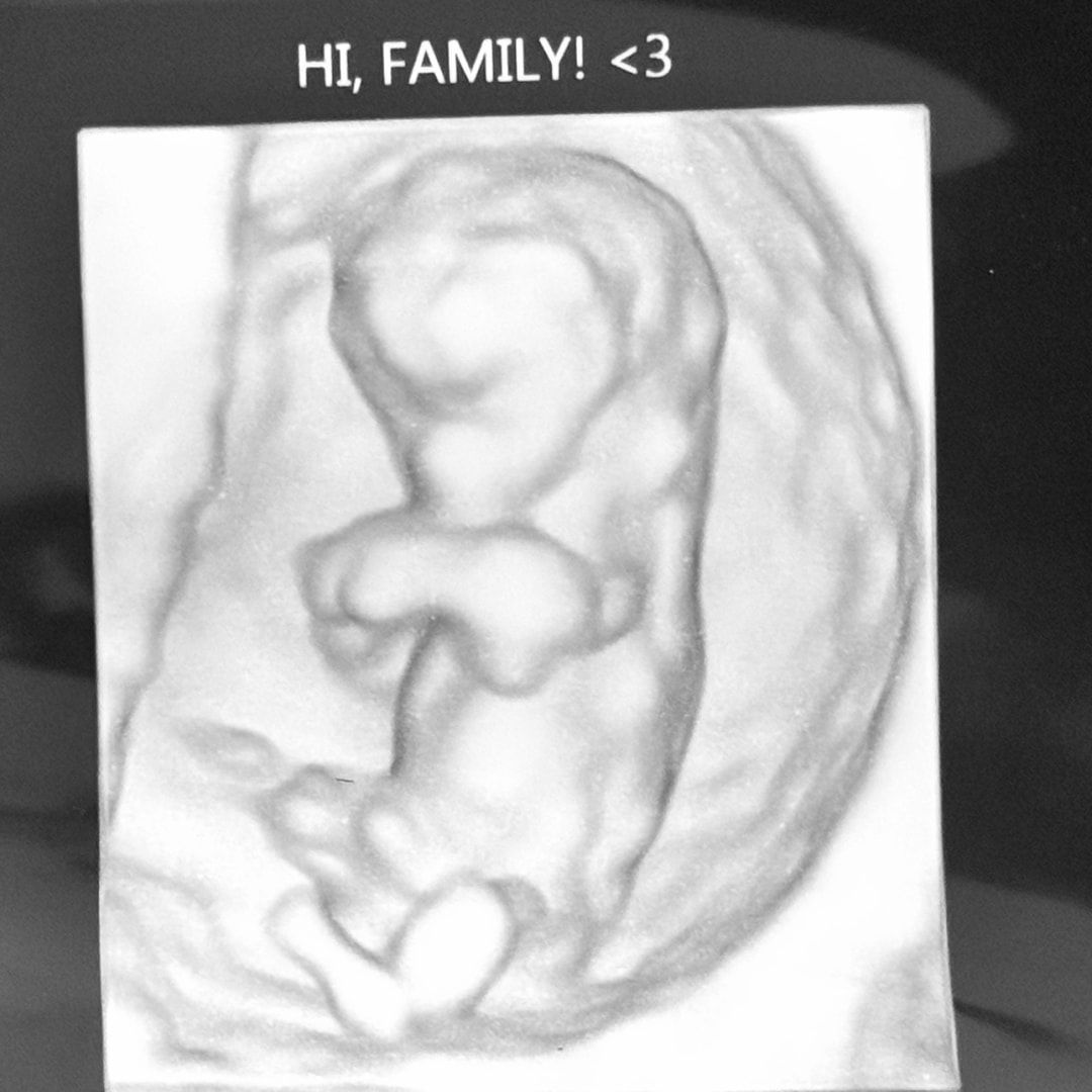 Photo shared by Megan for their Babylist baby registry.
