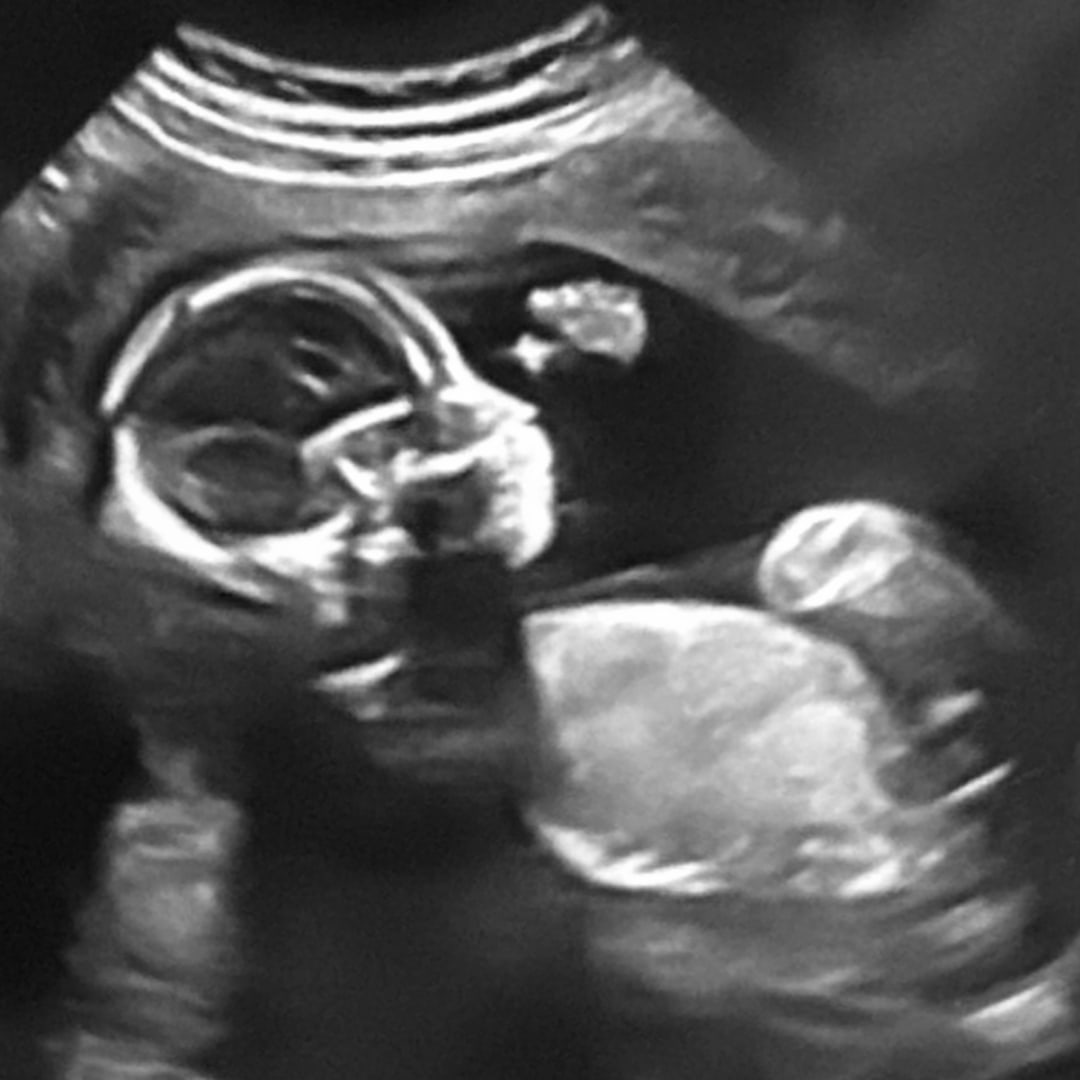 Photo shared by Nikki for their Babylist baby registry.