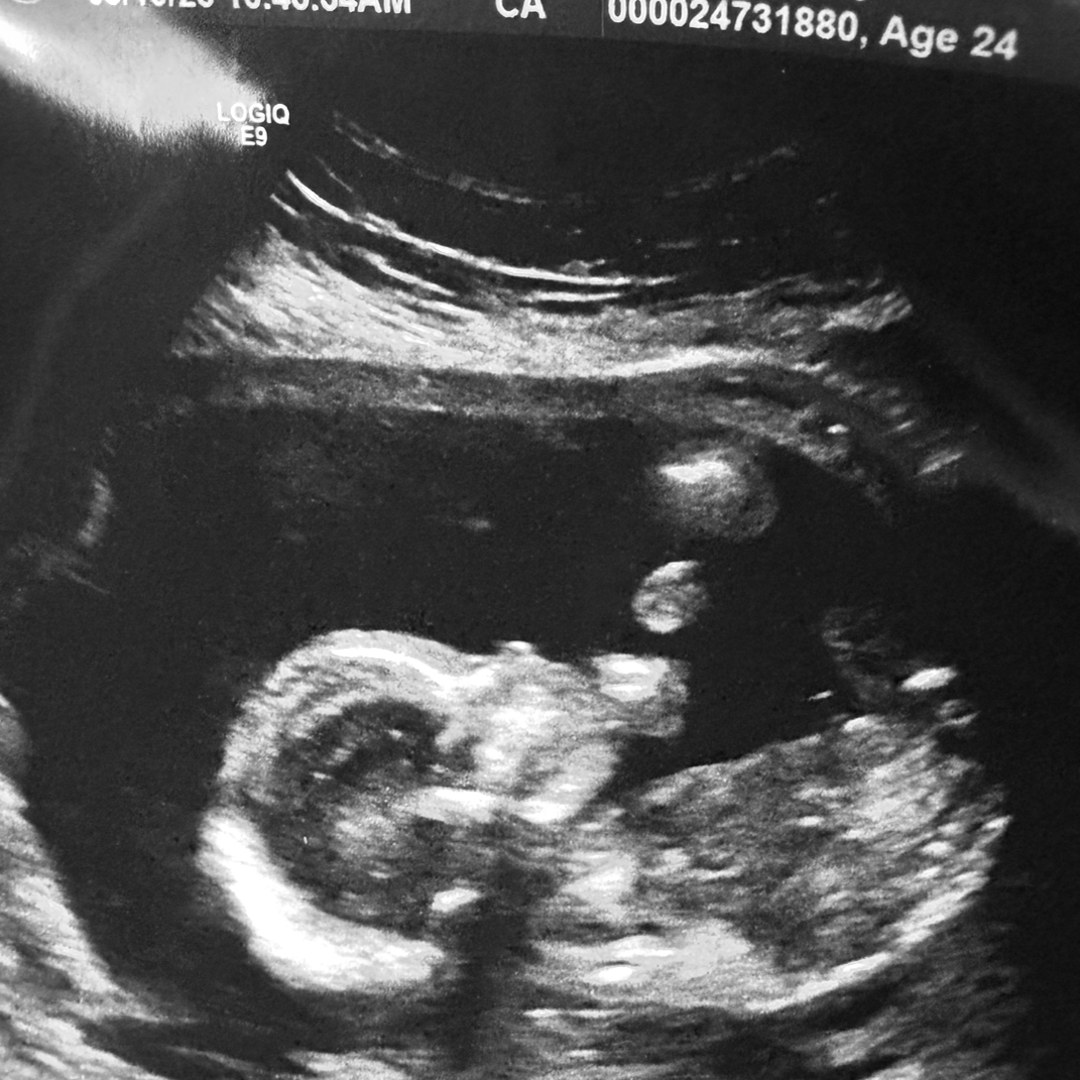 Photo shared by Emily for their Babylist baby registry.