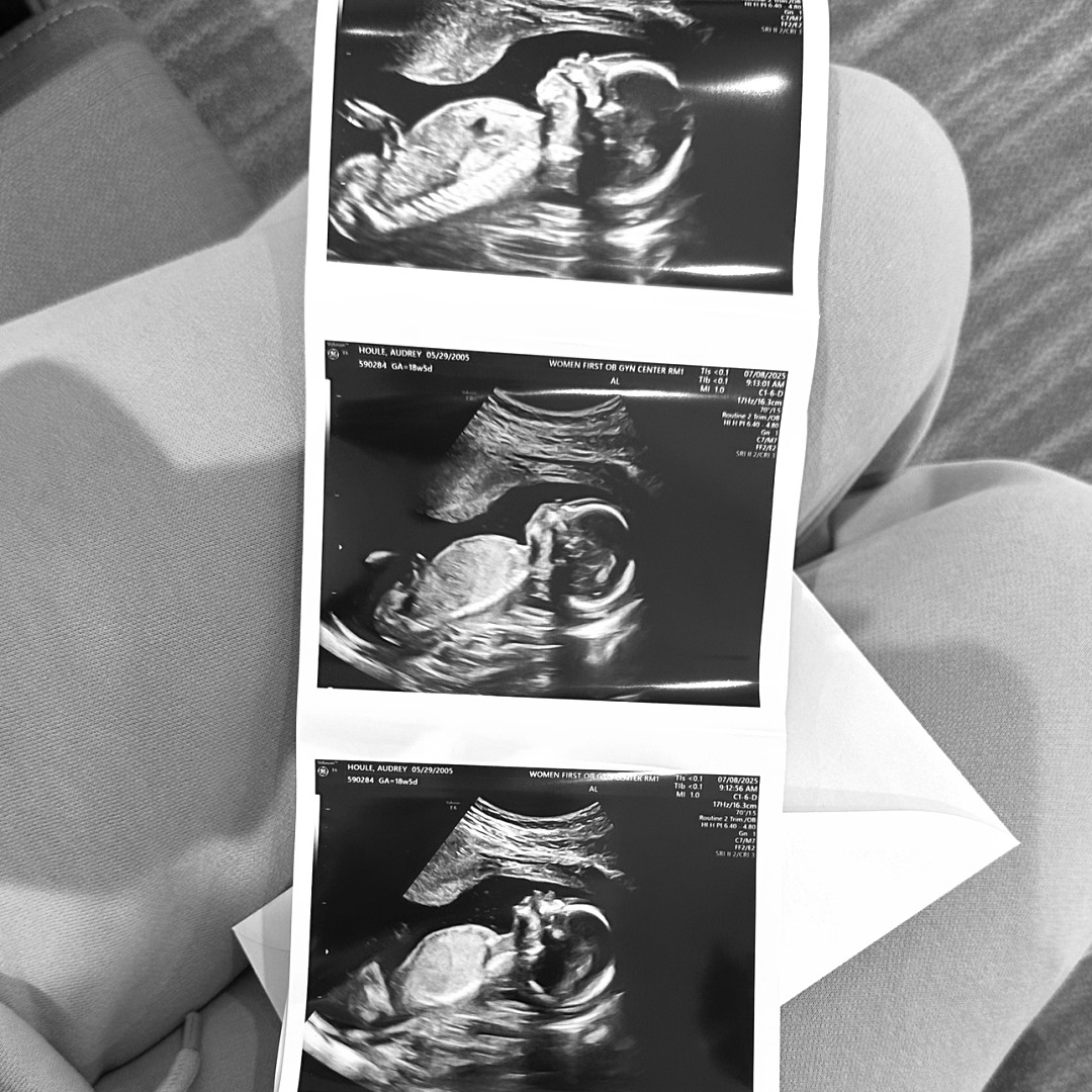 Photo shared by Audrey for their Babylist baby registry.