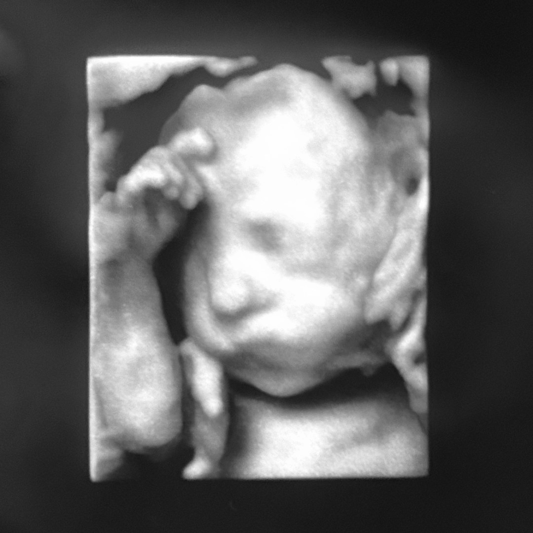 Photo shared by Emma for their Babylist baby registry.