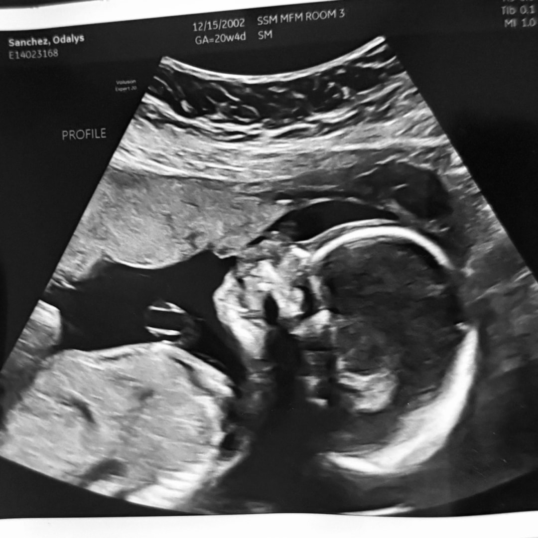 Photo shared by Odalys for their Babylist baby registry.