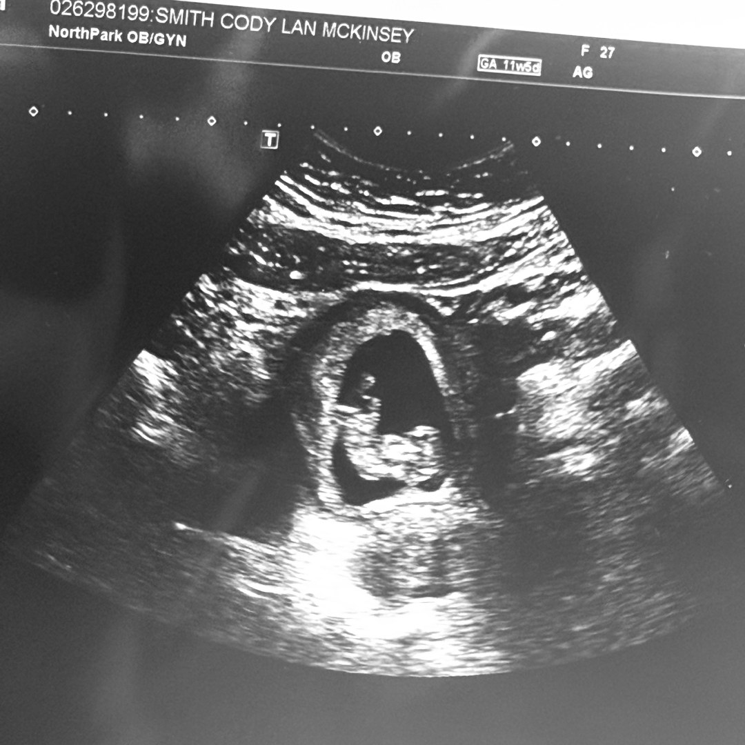 Photo shared by Cody for their Babylist baby registry.
