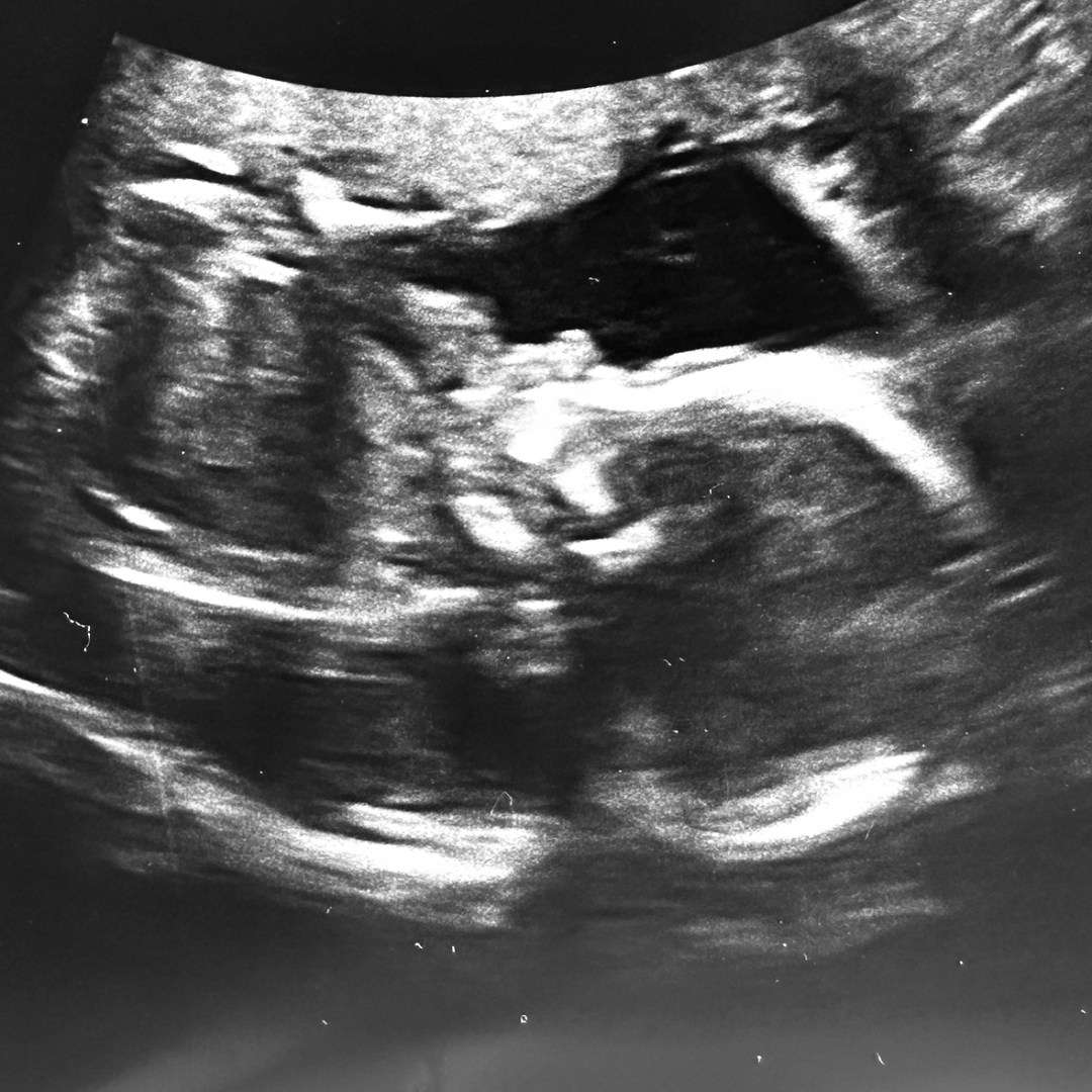 Photo shared by Hannah for their Babylist baby registry.