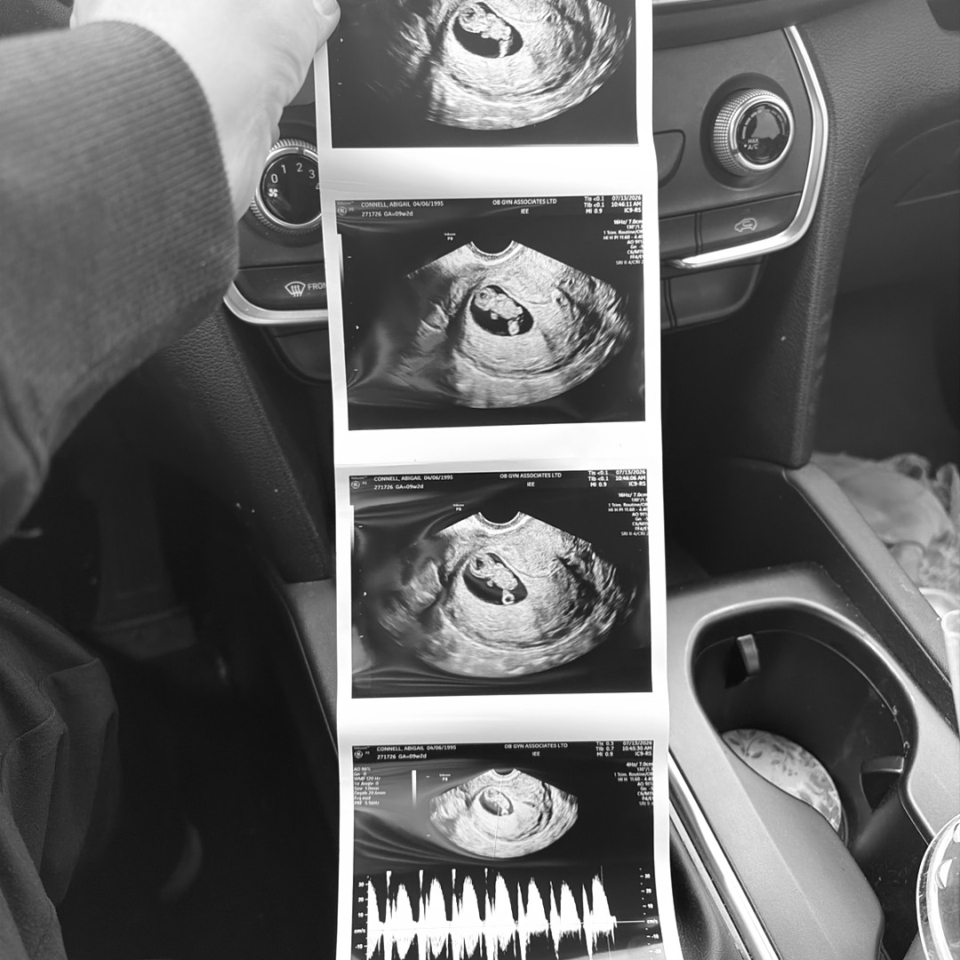 Photo shared by Abby for their Babylist baby registry.