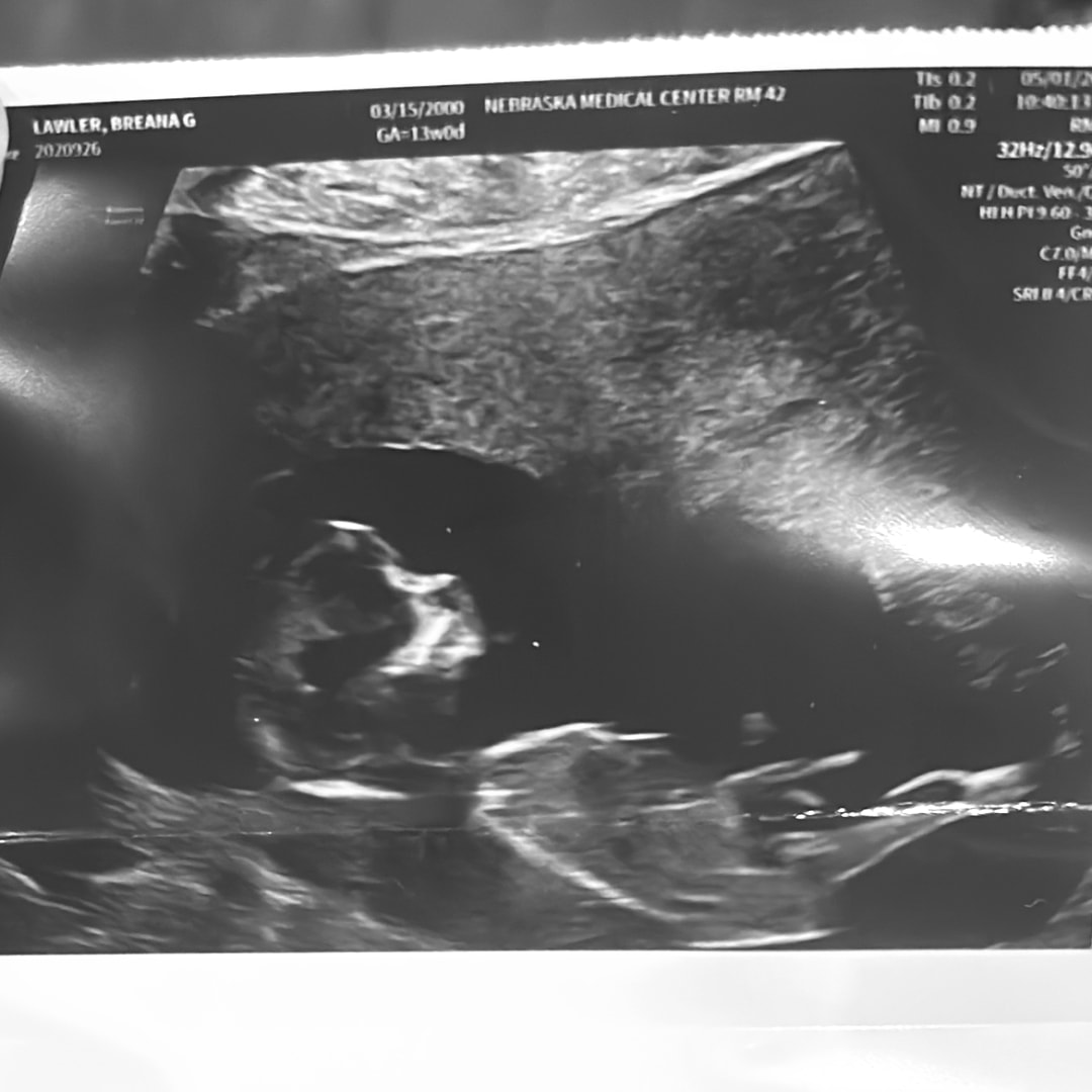Photo shared by Breana for their Babylist baby registry.