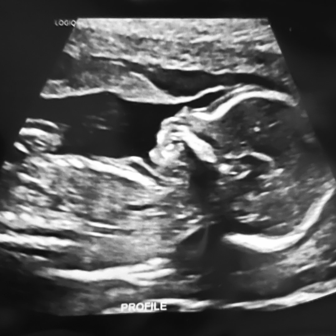 Photo shared by Iriz for their Babylist baby registry.