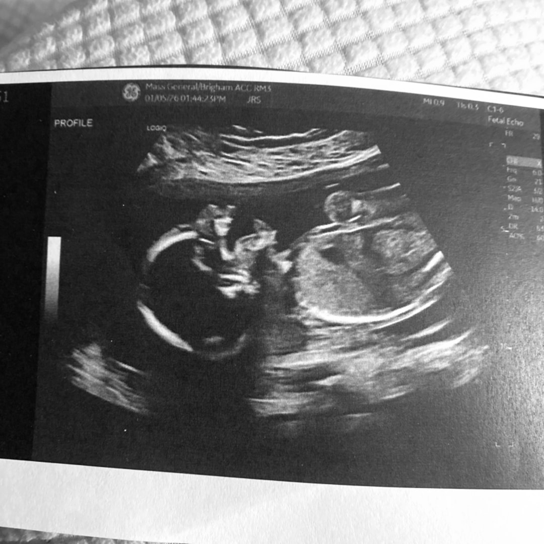 Photo shared by Danielle for their Babylist baby registry.