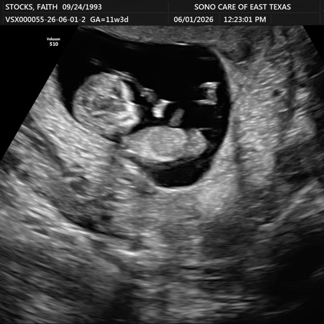 Photo shared by Faith for their Babylist baby registry.