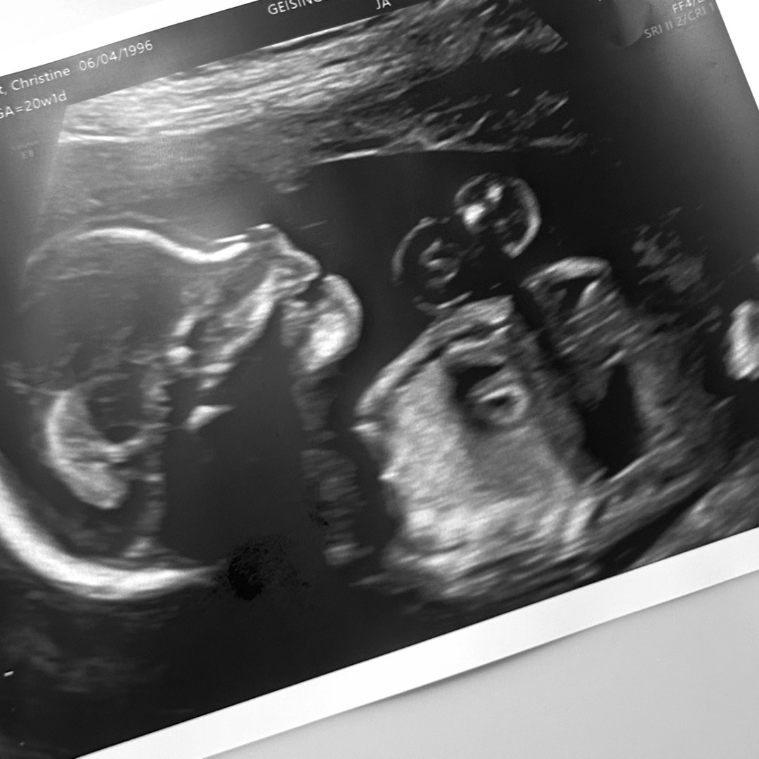 Photo shared by Christine for their Babylist baby registry.