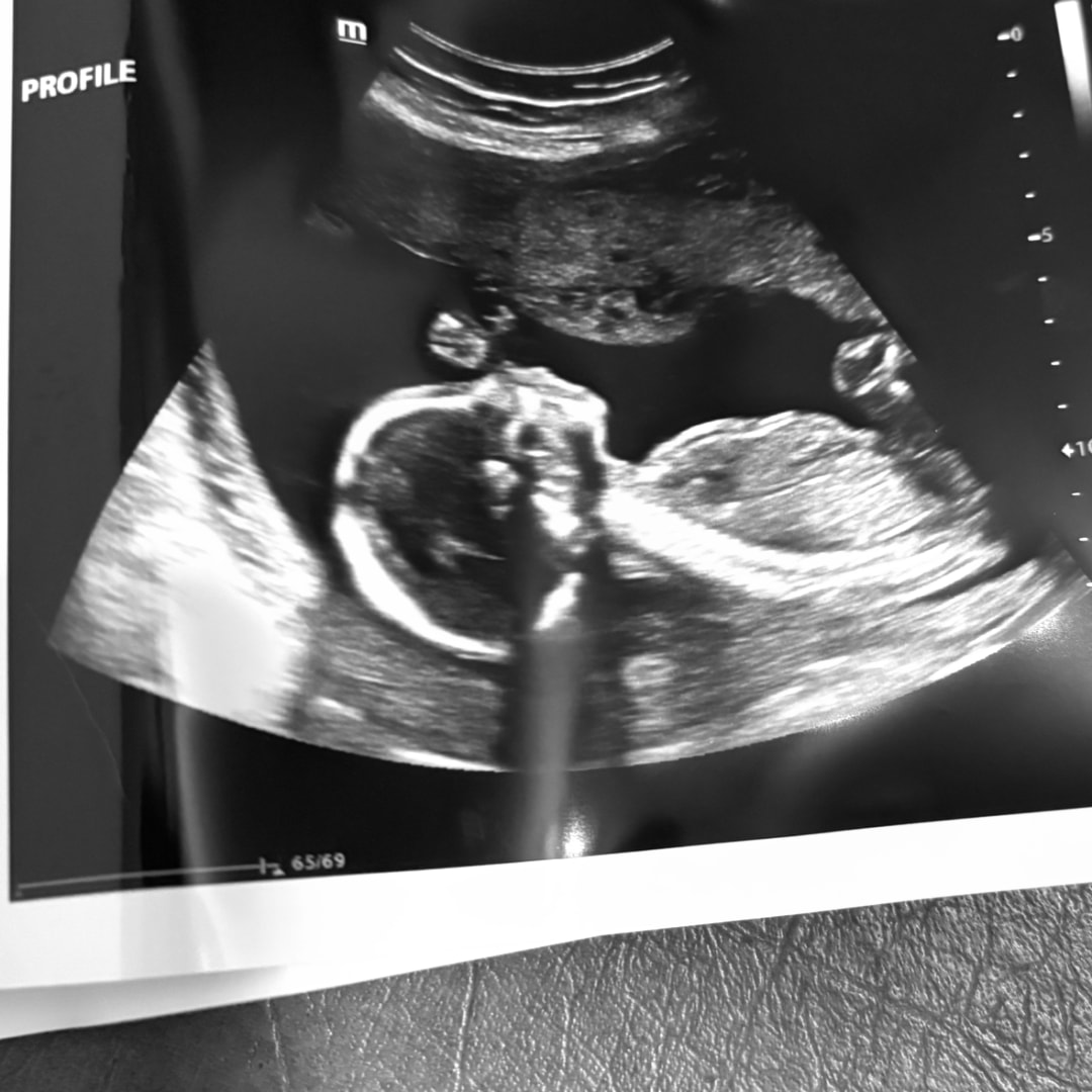 Photo shared by J & Chey for their Babylist baby registry.