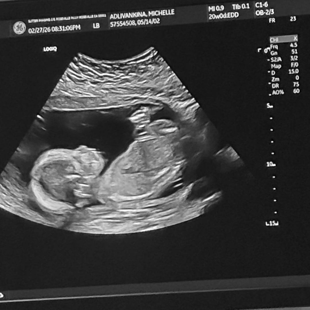 Photo shared by Joshua for their Babylist baby registry.