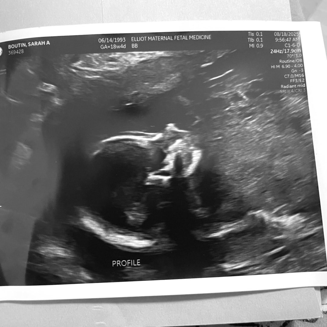 Photo shared by Sarah for their Babylist baby registry.