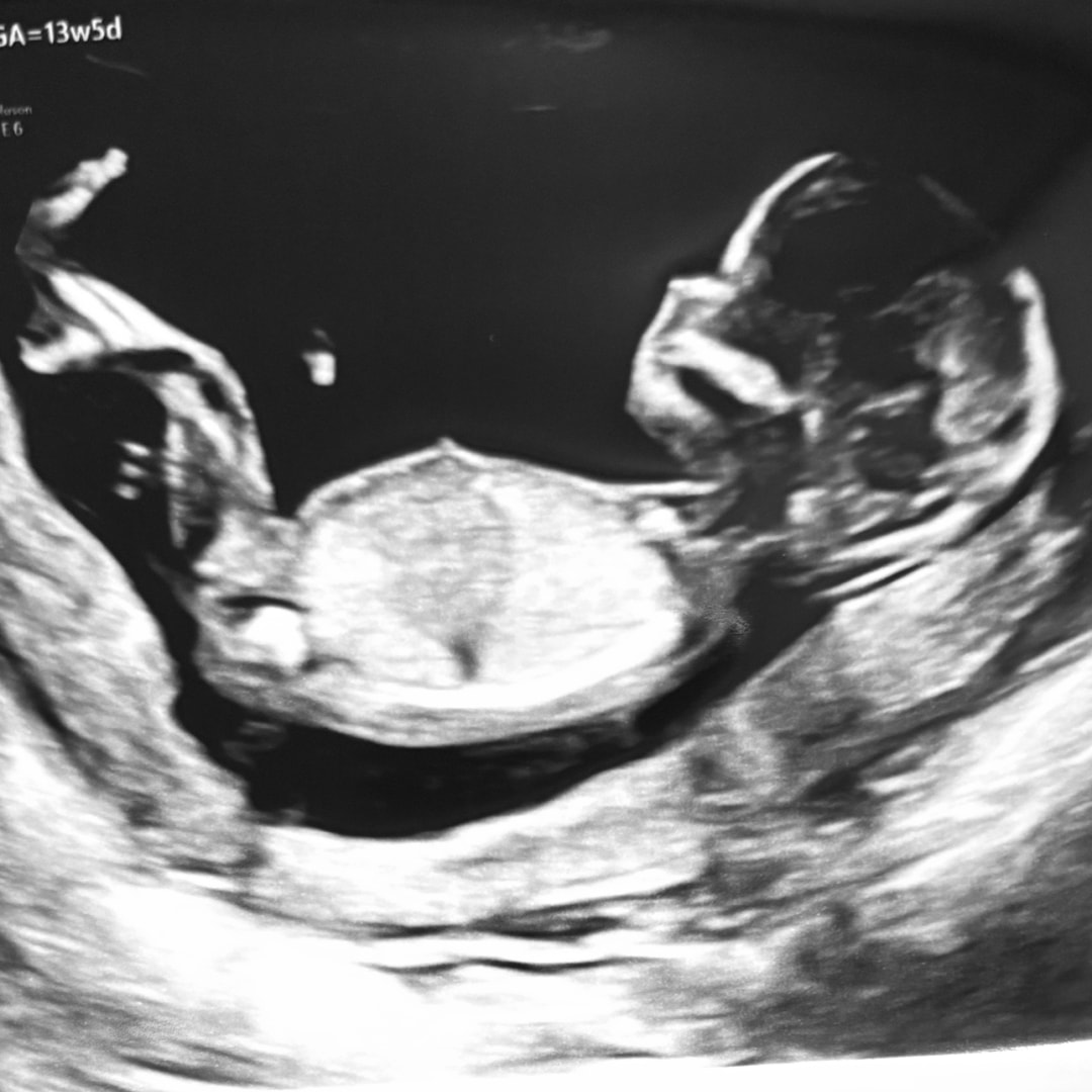 Photo shared by Meredith for their Babylist baby registry.